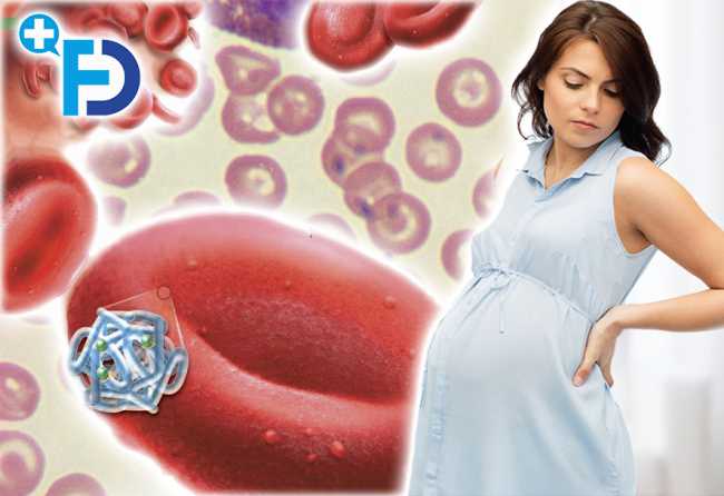 Анемія при вагітності