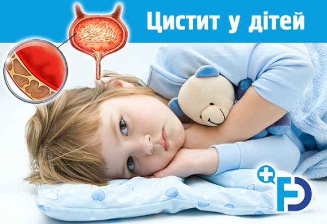 Цистит у дітей: симптоми, ознаки, лікування циститу у дітей