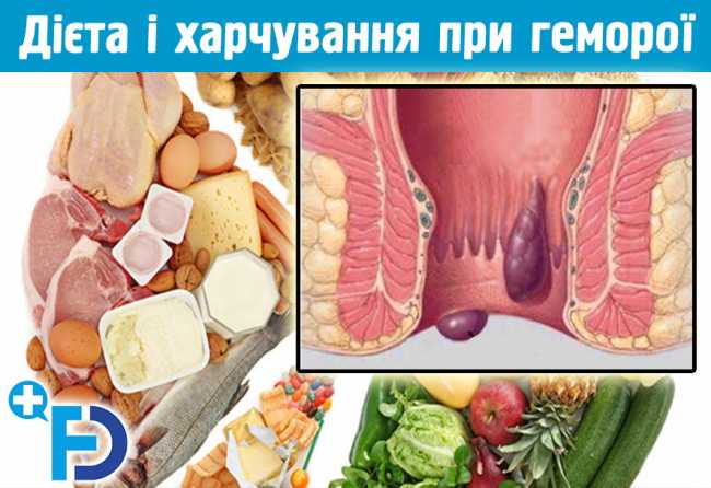 Дієта і харчування при геморої