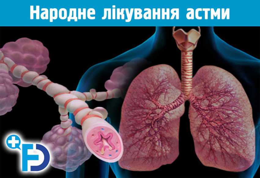Народне лікування астми, народні засоби при астмі