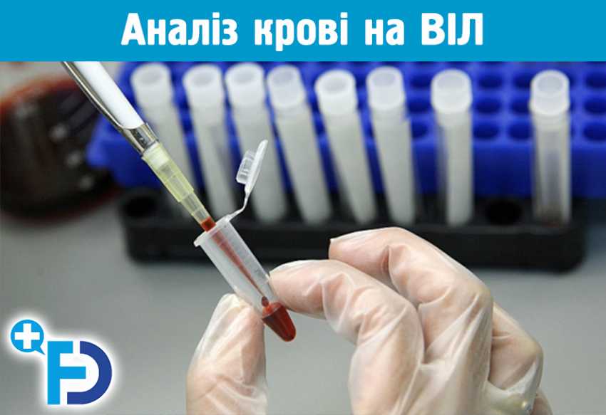 Аналіз крові на ВІЛ