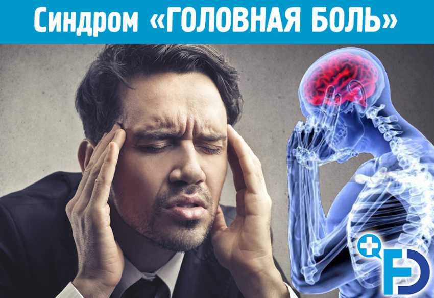 Синдром «ГОЛОВНАЯ БОЛЬ». Мигрень. Причины и симптомы головных болей.