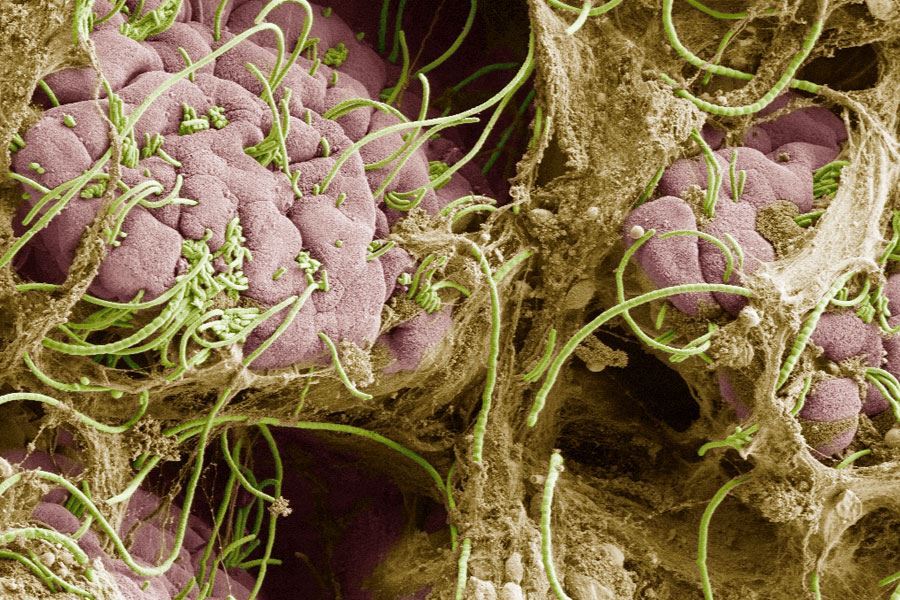 Сегментированные нитчатые бактерии - важное звено развития нарушений психики у мышей