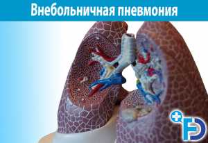 Внебольничная пневмония у детей и взрослых
