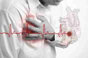 Вторинна профілактика інфаркту міокарду