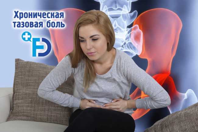 Хроническая тазовая боль у женщин. Причины и лечение
