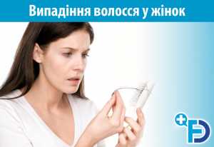 Випадіння волосся у жінок