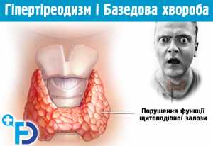 Порушення функції щитоподібної залози. ГІПЕРТІРЕОДИЗМ і Базедова хвороба