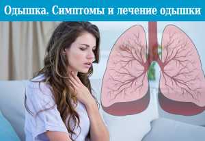 Одышка. Симптомы, причины и лечение одышки